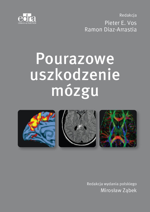 Pourazowe uszkodzenie mózgu, zdjęcie produktu, kategoria Choroby układu nerwowego