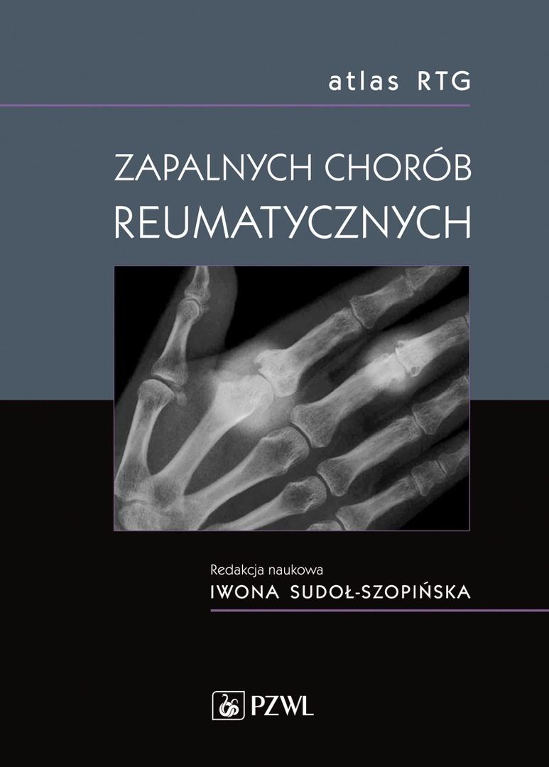 Atlas RTG zapalnych chorób reumatycznych, zdjęcie produktu, kategoria Choroby kręgosłupa i stawów
