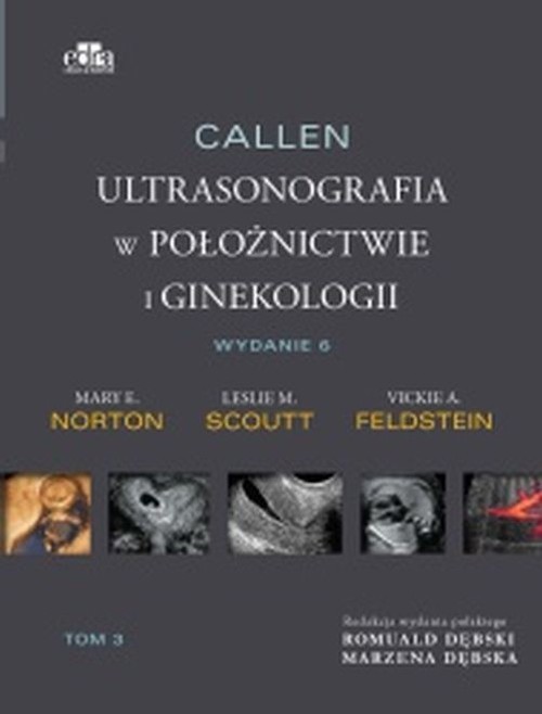 Callen. Ultrasonografia w położnictwie i ginekologii . Tom 3, zdjęcie produktu, kategoria Ciąża i macierzyństwo