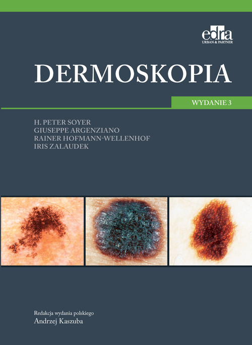 Dermoskopia, zdjęcie produktu, kategoria Choroby skóry