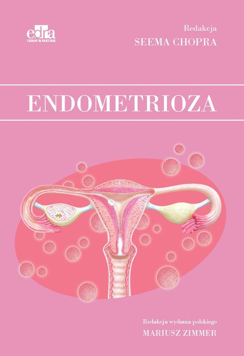 Endometrioza, zdjęcie produktu, kategoria Ciąża i macierzyństwo