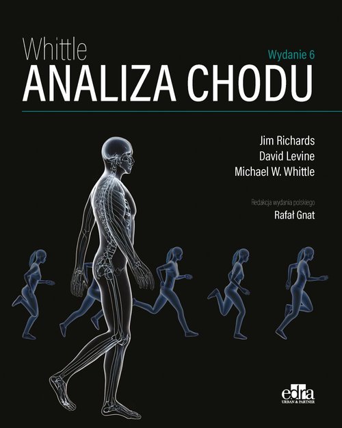 Analiza chodu Whittle, zdjęcie produktu, kategoria Choroby kręgosłupa i stawów
