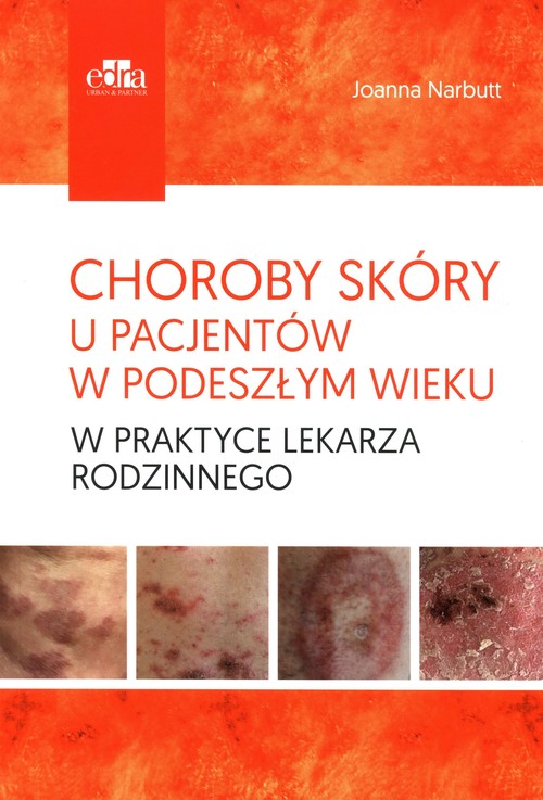 Choroby skóry u pacjentów w podeszłym wieku w praktyce lekarza rodzinnego, zdjęcie produktu, kategoria Choroby skóry