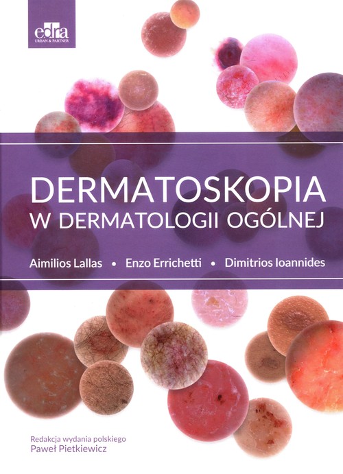 Dermatoskopia w dermatologii ogólnej, zdjęcie produktu, kategoria Choroby skóry