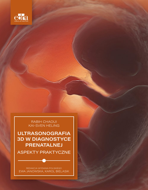 Ultrasonografia 3D w diagnostyce prenatalnej, zdjęcie produktu, kategoria Diagnostyka i leki
