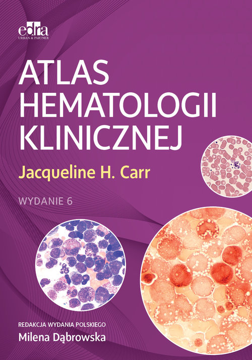 Atlas hematologii klinicznej, zdjęcie produktu, kategoria Choroby nowotworowe