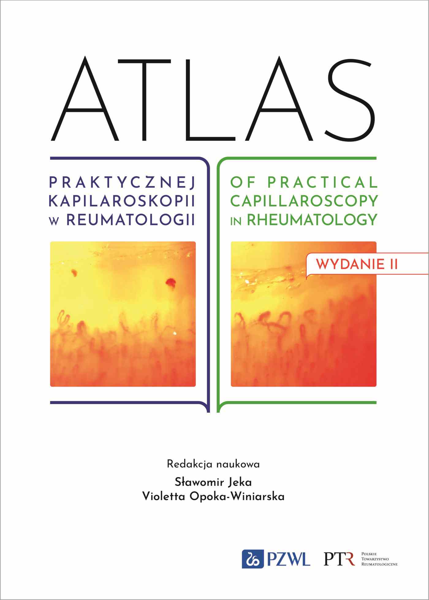 Atlas praktycznej kapilaroskopii w reumatologii. Atlas of practical capillaroscopy in rheumatology, zdjęcie produktu, kategoria Choroby kręgosłupa i stawów