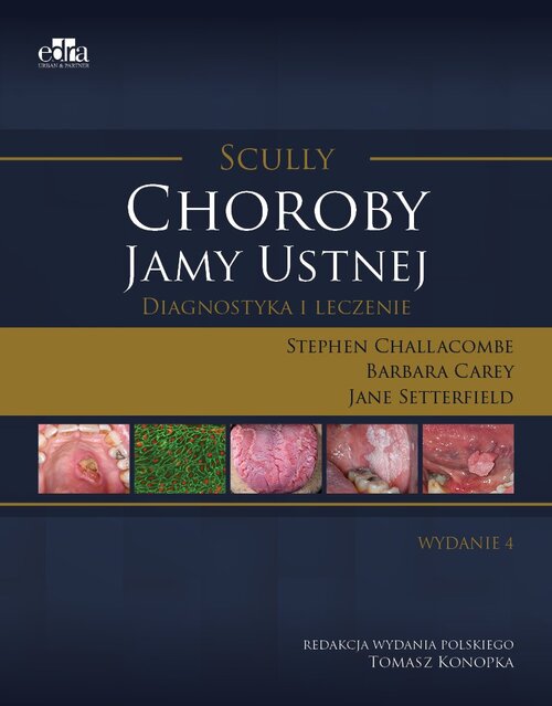 Choroby jamy ustnej. Diagnostyka i leczenie. Scully, zdjęcie produktu, kategoria Choroby zębów