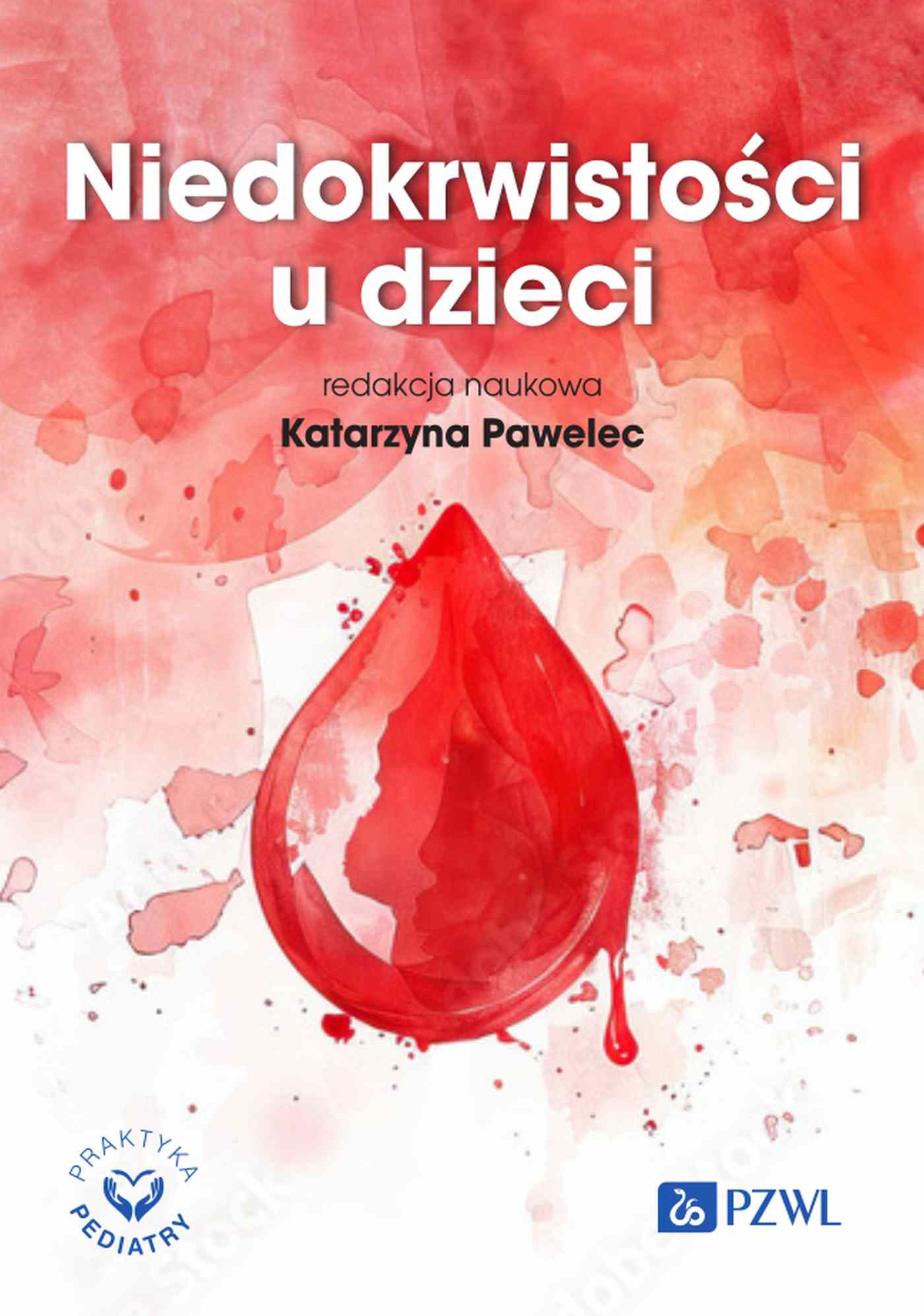 Niedokrwistości u dzieci, zdjęcie produktu, kategoria Choroby nowotworowe