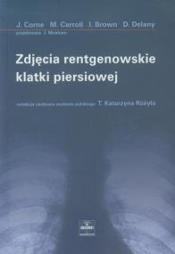 Okładka książki Zdjęcia rentgenowskie klatki piersiowej