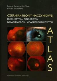 Okładka książki Czerniak błony naczyniowej. Diagnostyka różnicowa