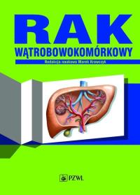 Rak wątrobowokomórkowy. Autor: Marek Krawczyk (red.). ZdrowePodejscie.pl Okładka książki Rak wątrobowokomórkowy