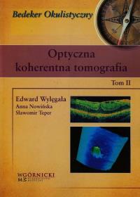 Optyczna koherentna tomografia Tom 2. Autor: Wylęgała Edward, Teper Sławomir. ZdrowePodejscie.pl Okładka książki Optyczna koherentna tomografia Tom 2