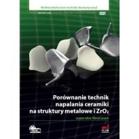 Opakowanie Porównanie technik napalania ceramiki na struktury metalowe i ZrO2