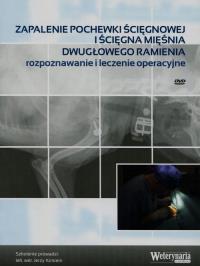 Okładka książki Zapalenie pochewki ścięgnowej iścięgna mięśnia dwugłowego ramienia