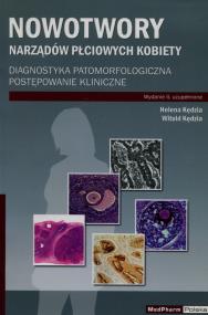 Okładka książki Nowotwory narządów płciowych kobiety