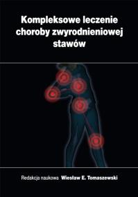 Opakowanie Kompleksowe Leczenie Choroby Zwyrodnieniowej Stawów