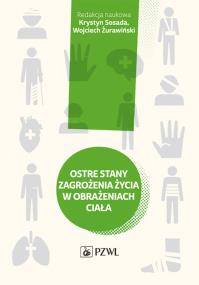 Ostre stany zagrożenia życia w obrażeniach ciała. Autor: Wojciech Żurawiński, Krystyn Sosada. ZdrowePodejscie.pl Okładka książki Ostre stany zagrożenia życia w obrażeniach ciała
