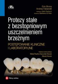 Okładka książki Protezy stałe