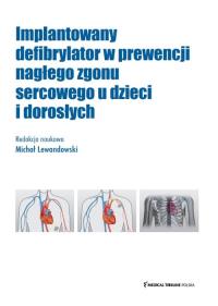 Okładka książki Implantowany defibrylator w prewencji nagłego zgonu sercowego u dzieci i dorosłych