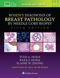 Rosen's Diagnosis of Breast Pathology. Autor: Hoda Syed A., Raza S. Hoda. ZdrowePodejscie.pl Okładka książki Rosen's Diagnosis of Breast Pathology