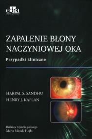 Okładka książki Zapalenie błony naczyniowej oka