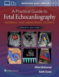 Okładka książki A Practical Guide to Fetal Echocardiography