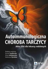 Okładka książki Autoimmunologiczna choroba tarczycy