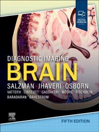 Okładka książki Diagnostic Imaging . Brain