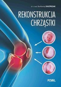 Okładka książki Rekonstrukcja chrząstki