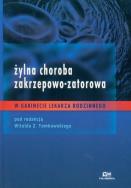 Opakowanie Żylna choroba zakrzepowo-zatorowa