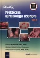 Praktyczna dermatologia dziecięca Tom 2. Wydawca: Czelej. ZdrowePodejscie.pl Opakowanie Praktyczna dermatologia dziecięca Tom 2