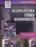 Alloplastyka stawu biodrowego z płytą DVD. Autor: Dorr Lawrence D.. ZdrowePodejscie.pl Okładka książki Alloplastyka stawu biodrowego z płytą DVD