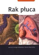 Rak płuca. Autor: praca zbiorowa. ZdrowePodejscie.pl Okładka książki Rak płuca