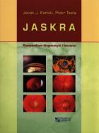 Jaskra. Autor: Kański Jacek J., Tesla Piotr. ZdrowePodejscie.pl Okładka książki Jaskra