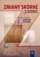Zmiany skórne w chorobach ogólnoustrojowych Tom 1. Wydawca: Czelej. ZdrowePodejscie.pl Opakowanie Zmiany skórne w chorobach ogólnoustrojowych Tom 1
