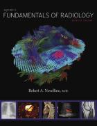 Squire's Fundamentals of Radiology. Autor: Novelline Robert A.. ZdrowePodejscie.pl Okładka książki Squire's Fundamentals of Radiology