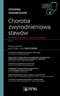 Choroba zwyrodnieniowa stawów. Autor: Majdan Maria. ZdrowePodejscie.pl Okładka książki Choroba zwyrodnieniowa stawów