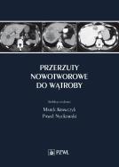 Przerzuty nowotworowe do wątroby. Autor: Krawczyk Marek. ZdrowePodejscie.pl Okładka książki Przerzuty nowotworowe do wątroby