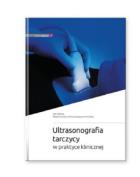 Ultrasonografia tarczycy w praktyce klinicznej. Autor: M. Ruchała, E. Szczepanek-Parulska. ZdrowePodejscie.pl Okładka książki Ultrasonografia tarczycy w praktyce klinicznej