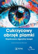 Okładka książki Cukrzycowy obrzęk plamki.
