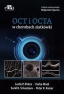 Okładka książki OCT i OCTA w chorobach siatkówki