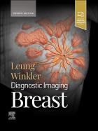 Okładka książki Diagnostic Imaging. Breast